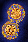 Coronavirus, TEM