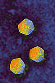 Hepatitis A virus, TEM