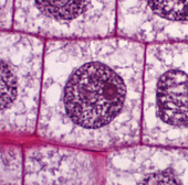 Interphase in onion root tip cell, light micrograph