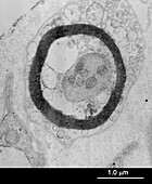 Myelinated nerve, foreskin, TEM