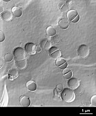 Group a beta-streptococcus bacteria, TEM