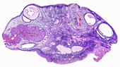 Rabbit ovary, light micrograph