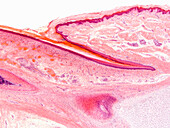 Human nailbed skin, light micrograph