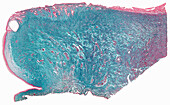 Human cervix, light micrograph