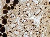 Lactating human mammary gland, light micrograph