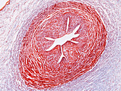 Human umbilical cord, light micrograph