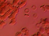 Human red blood cells, light micrograph