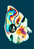 Graupel grain, polarised light micrograph