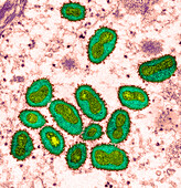 Monkeypox virus particles, TEM