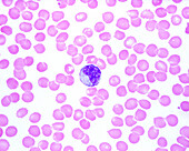 Human blood smear with monocyte, light micrograph