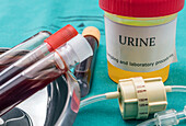 Urine and blood samples at hospital table, conceptual image