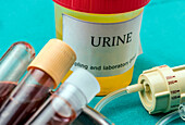 Urine and blood samples on a hospital table