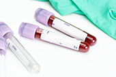 Blood sample collection