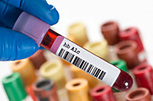 Haemoglobin A1c blood test tube