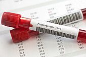 Progesterone blood test tubes