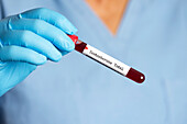 Testosterone blood sample tube