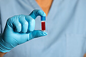 Technician with small blood sample tube