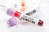 Covid-19 blood test