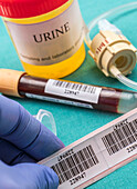 Doctor labelling blood sample at a hospital table