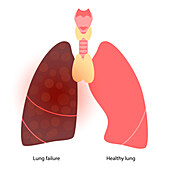 Effects of tobacco smoking, illustration