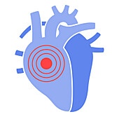 Cardiology, conceptual illustration