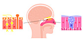 Nasal cavity anatomy, illustration