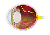 Cat eye with hypertension, illustration