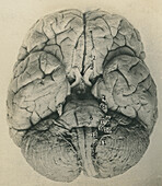 Base of the brain