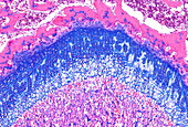 Epiphyseal growth plate, light micrograph