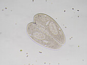 Paramecium conjugation, light micrograph