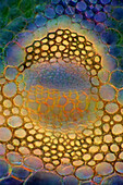 Dock (Rumex sp.) vascular bundle, light micrograph