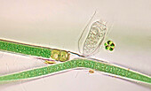 Vaginicola ciliate on cyanobacteria, light micrograph