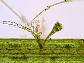 Algae and ciliate on aquatic plant, light micrograph