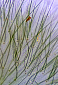 Rivularia cyanobacteria, light micrograph