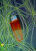 Floscularia rotifer, light micrograph