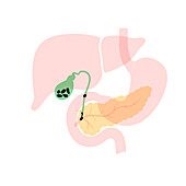 Pancreas and gallbladder, illustration