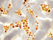 Staphylococcus bacteria biofilm, illustration