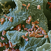 Coral berry leaf with symbiotic bacteria, SEM