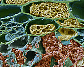 Coral berry leaf with symbiotic bacteria, SEM