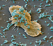 Amoeba and bacteria, SEM