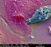 Entamoeba protozoan, SEM