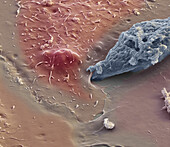 Entamoeba protozoan, SEM