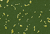 Salmonella infantis bacteria, SEM