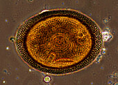 Bryozoan egg, light micrograph