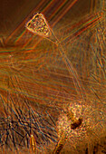 Suctorian ciliate, light micrograph