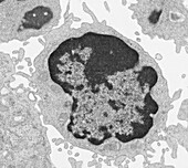 Large lymphocyte, TEM