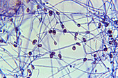 Pseudallescheria boydii, light micrograph
