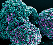 Cell infected by SARS-CoV-2 Omicron virus particles, SEM