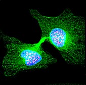 Human cell in telophase, light micrograph
