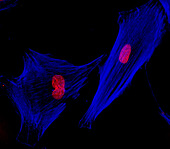 Human fibroblast cells, light micrograph